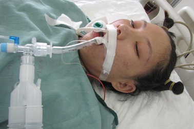  Sản phụ Hà Thị Ngân đã được mổ để cứu đứa con trong bụng